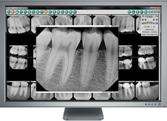 Digital Radiography